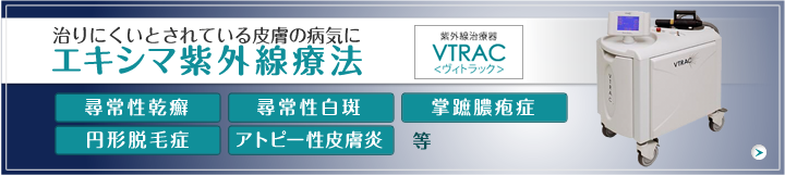 治りにくいとされている皮膚の病気にエキシマ紫外線療法 尋常性乾癬、尋常性白斑、掌蹠膿疱症、円形脱毛症、アトピー性皮膚炎　等